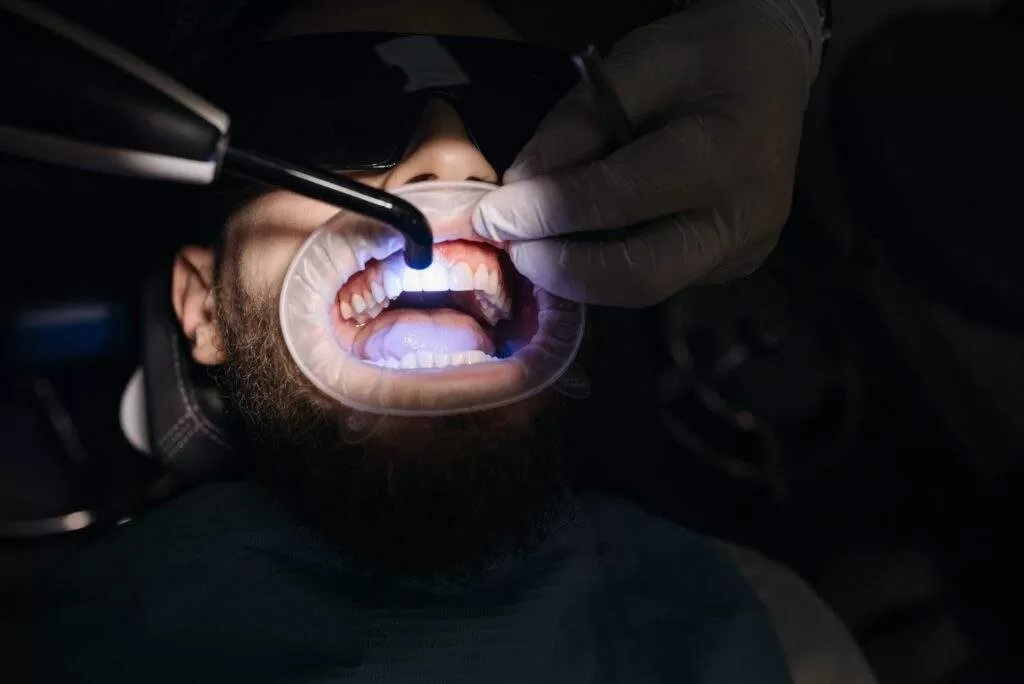 blanqueamiento dental económico
