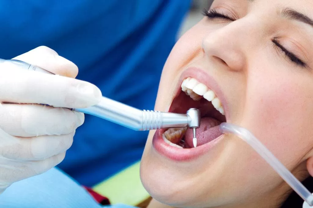 Limpieza dental ultrasónica